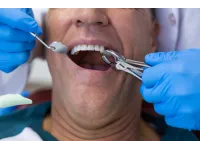 حكم خلع الضرس في نهار رمضان: هل يبطل الصيام وما هو رأي دائرة الافتاء؟