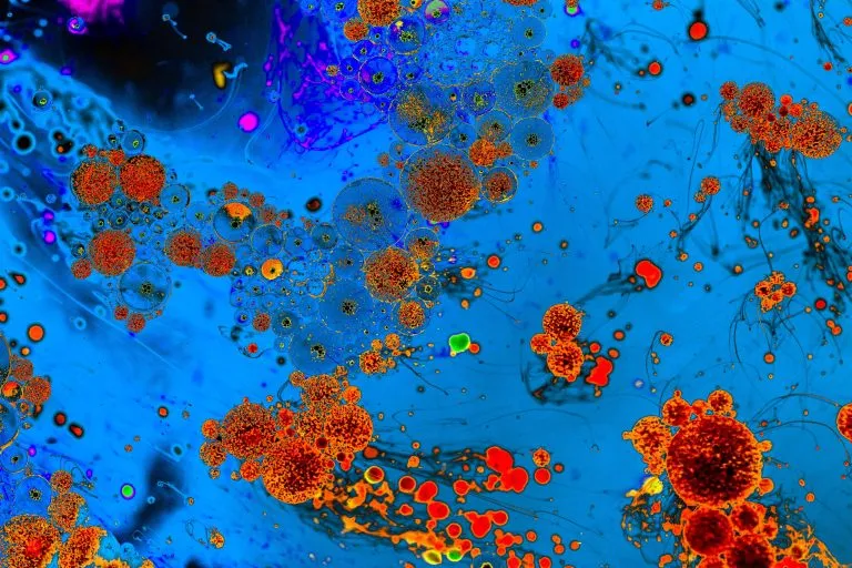 طوارئ في الطفيلة.. فيروس "نيومونيا" يداهم مركز ايواء العيص ويدخل 15 فتاة للمستشفى